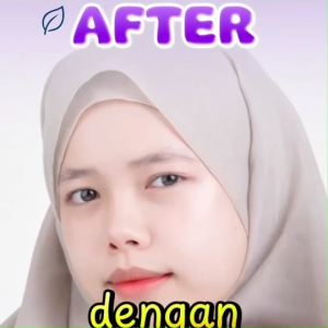 Toner Pad Kit Seyoul Untuk Mengurangi Minyak Berlebih Serta Membersihkan Pori-Pori dan Meningkatkan Kecerahan Kulit