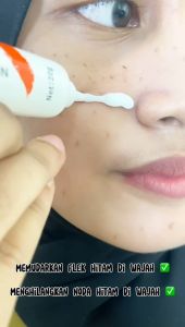 [PROMO 5PCS] CINDYNAL Niacinamide Skin Cream 20g