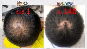 เซรั่มปลูกคิ้ว น้ำยาปลูกหวด 30ml - ราคาพิเศษ สำหรับใช้กับ คิ้ว, เครา, ส้ม, เส้นผม, ยาปลูกหนวด, น้ำยาปลูกคิ้ว, เซรั่มปลูกผม, น้ำยาปลูกผม เซรั่มปลูกจอน