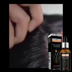 Hair Growth Serum Anti Hair Loss Products Fast Regrowth Essential Oil Repair Scalp Frizzy Thinning Damaged Hair Care Essential Oil 30ml