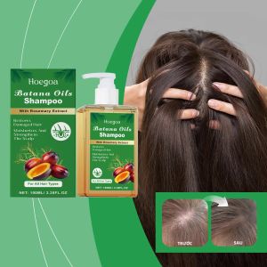 Dầu Gội Batana Rosemary Cho Sức Khỏe Da Đầu Chống Gàu Kiểm Soát Dầu Ngăn Ngừa Rụng Tóc Phục Hồi Tóc Hư Tổn - 100ml