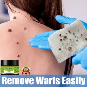 Remove wart antibacterial Ointment Warts Remover Body Warts Cream Skin Tag Remover deep penetration wart inhibit fungal growth Warts Ointment