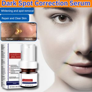 Dark Spot Correction Serum Moisturizer Facial Essence Remove Dull Spots Pigment Marks Freckle-Banishing Serum