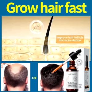 Hair Growth Serum minyak rambut cepat panjang dan lebat 60ml tonic Herbal biotin supplement for hair growth women man Prevent hair loss Shampoo