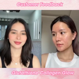 whitening freckle facial Natural Glutathione collagen gummies brightening skin care