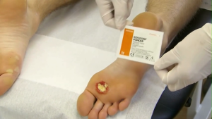 Iodosorb Powder 3g - Promotes Wound Healing (1 sachet 3g) Antimicrobial Iodine Wound Care Dressing for Infection Control & Ulcer Healing