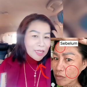 PHARMASKIN SOLUTION Paket Whitening Flek Hitam