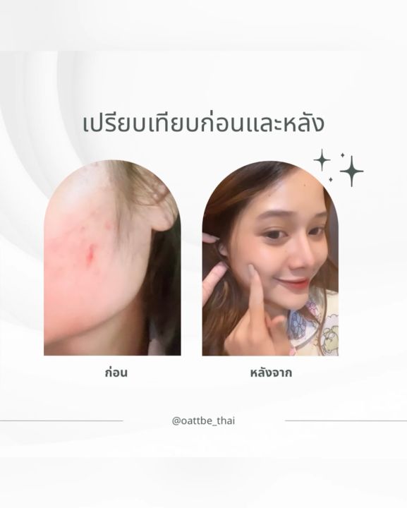 เจลล้างหน้า สูตรอ่อนโยนต่อผิวแพ้ง่าย Oattbe Syn Bio B-Glucans Calming ...