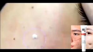 【ARK】Krim Penghilang Flek Hitam Bintik Mencerahkan Kulit Menghilangkan Bintik Hitam BE016