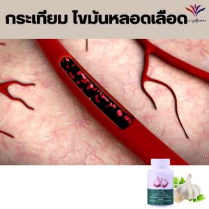 ส่งฟรี กระเทียมสกัด100แคปซูล คลอเลสเตอรอล ไขมัน สมุนไพรสกัด Giffarine กระเทียมผงสกัด 400 มก จำนวน100แคปซูล ส่งไว