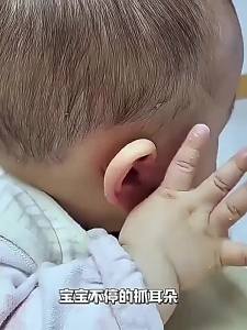 IMLUCKY | Illuminated Silicone-tipped Childrens Earwax Removal Tool