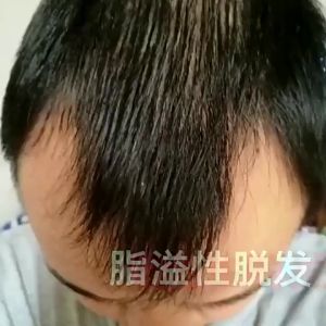 Shampo Penumbuh Rambut Cepat Perawatan Rambut Rontok Anti Botak 500ml Efektif Menumbuhkan Rambut Menyuburkan Rambut Menghilangkan Uban Shampo Rambut Anti Ketombe Gatal Ginger Juice Hair Growth Shampoo