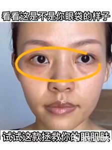 Eye Serum Mata & Menghilangkan Kantong Mata: Langkah Mudah dengan Anti Kerut Eye Cream