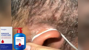 Anti-dandruff shampoo Selenium Disulfide Shampoo Oil Control Anti-Dandruff Anti-Itch Clear Malassezia Pengendalian Minyak Anti Ketombe Anti Gatal Sampo 120ML