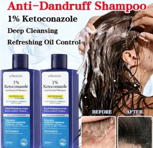 Ketoconazole Anti-Dandruff Shampoo for Itchy Scalp Oily Hair Control – 265g KORMESIC with Tea Tree