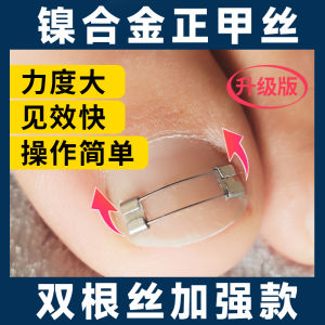 Nickel Alloy Nail Corrector Wire Traction Steel Wire for Ingrown Toenail Professional Use Foot Pedicure Tool Home Care Kit