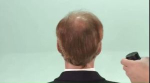 เส้นผม สมุไพรปิดผมบาง ผงไฟเบอร์ปิดผมบาง ปิดหัวล้าน ผมดก ผมหนา เพิ่มความหนา ปิดเหม่ง, ปิดรอยแสก เพิ่มวอลูมเส้นผม