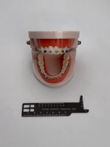 Alat Ukur Gigi Gusi Crown Veneer / Dental Esthetic Measuring Gauge