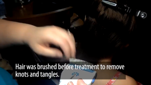 Sisir Kutu V-Comb Elektrik Vacuum Alat Pembersih Telur Kutu Ketombe Lice Comb Rambut