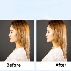 Stretching Straps Face Lift Face Lift Tape Invisible Face Lift Band To Remove Eye Crows Feet