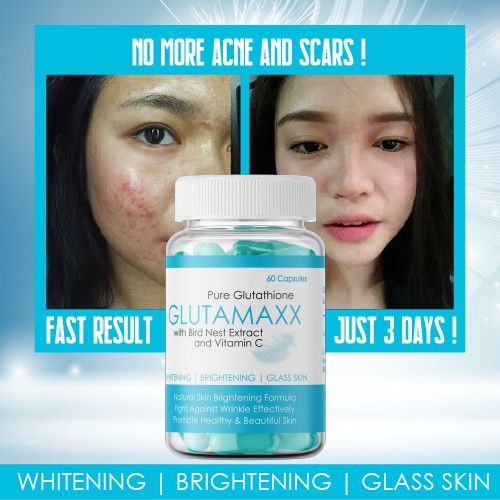 PURE GLUTATHIONE GLUTAMAXX WITH BIRD NEST EXTRACT AND VITAMIN C / WHITENING  CAPSULES | Lazada