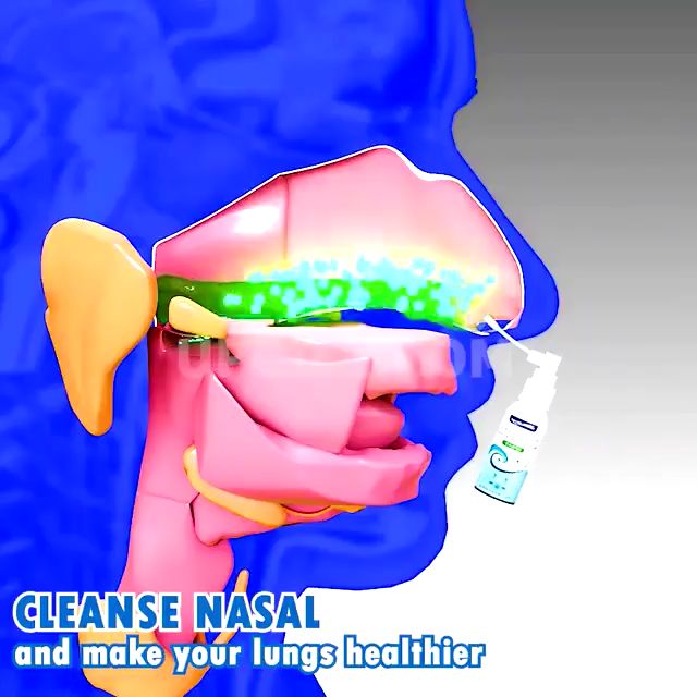 Nasal Spray Obat Semprot Hidung Tersumbat Traditional Medical Herb Spray Rhinitis Treatment Hidung Pilek Terapi Kesehatan Allergy