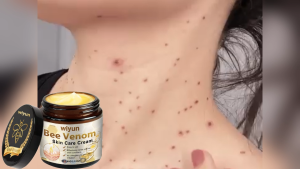 Wiyun  Bee Venom Mole Removal Skin Care Cream   Herbal Gentle Skin Mole Lightening Cleansing Skin Care Cream