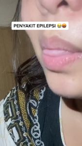 ETHERAL BHARATA ORIGINAL Obat Epilepsi Ampuh Anak Dan Dewasa