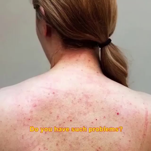 [SG]Sulfur Net Mite Shampoo: Deeply cleanses removes acne inhibits bacteria relieves itching and smoothens skin text