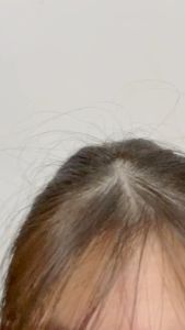 LANBENA Hair Growth Essential Oil - Mencegah Kerontokan (20 ml) [BPOM]