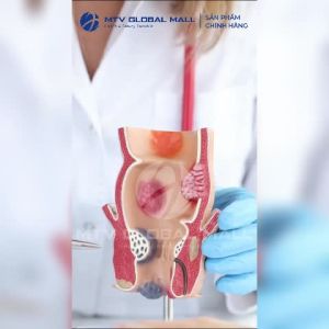 Viên Uống Trimax Dân Khang Hỗ Trợ Co Thắt Búi Trĩ Giảm Sưng Đau Do Trĩ Hộp 30 viên