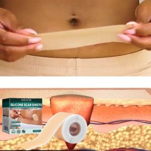 【BUY 3 GET 2】Eelhoe Silicone Scar Sheets Patch Painless Scar Repair Roll Removal Strips For C-Section Repair Damaged Skin (4*150cm)