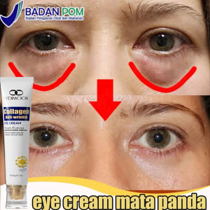Eye Cream Mata Panda Brightening Eye Cream Menghilangkan Kantong Mata Garis Halus Lingkaran Mata Hitam Eye Cream Penghilang Milia Di Mata Butiran Lemak Krim Mata Panda Dan Keriput