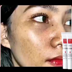Whitening Freckle Cream 20g Penghilangkan Bintik Gelap Anti Bintik Niacinamide Memudar Pigmentasi Melasma Dan Mencerahkan Krim