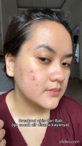 TERATU BEAUTY Skin Barrier Serum (Super Serum for Skin Barrier Recovery)