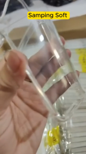 Case for Samsung Z Flip 7 5G Softcase CRYSTAL CLEAR Casing Case Hp Samsung Z Flip 7 5G