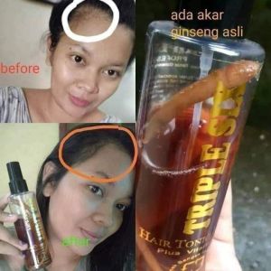TRENDING SERUM PENUMBUH RAMBUTPELEBAT RAMBUTPEMANJANG RAMBUT BISA COD