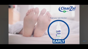 ClearZal® BAC Antimicrobial Nail Solution 30 ml / 1 ft oz