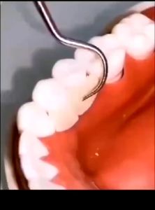 Tusuk Gigi Stainless 7 in 1/ Alat Pembersih Gigi Anti Karat Anti Patah - CTShop