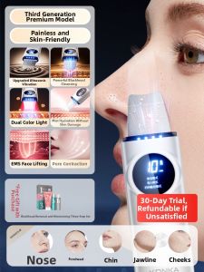 KONKA | Ultrasonic Blackhead Removal Device Beauty Tool Facial Tightening