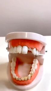 Keo Đặc Răng Giả Kẽ Hở Và Răng Giả Nhựa Tạo hình răng thỏ/10ml/30ml