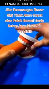 500 BUTIR PENAMBAL GIGI BERLUBANG TEMPTOOTH GIGI PALSU