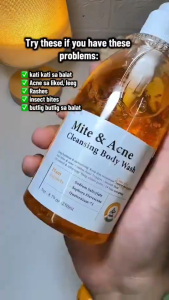Mite Acne Cleansing Body Wash France Imported Gentle Foaming Soft Cleanse Fights Inflammation Soothes Redness Plant Miticide Eliminates Bacteria Growth Sodium Salicylate Softens Rough Skin Unclogs Pores Zinc PCA Controls Oil Minimizes Shine Shower Gel