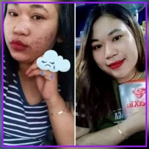 Skincare Maxie Bpom ORI