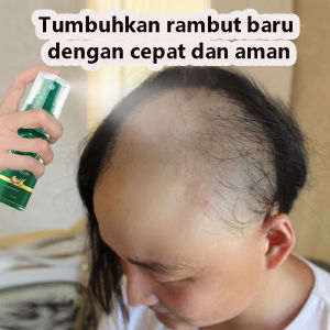 hair growth spray penumbuh rambut cepat dan tebal dewasa produk penumbuh rambut wanita dan pria 30ml