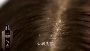 Shampoo Anti Rambut Rontok & Dandruff: Pilihan Terbaik untuk Anda