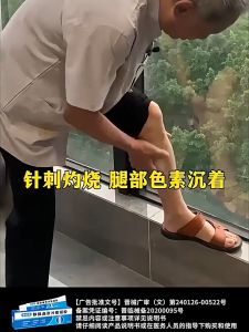 Cool Compress Gel for Varicose Veins: A Relief Product