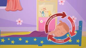 [Fast Delivery] Ezerra PLUS Cream for Baby Eczema/Dermatitis/Dry Skin 25g Red Inflammed Itchy Flareup Rash Children Infant | Dermatologist & PD Recommended