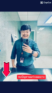 100% รวม สมุนไพร 17 ชนิด เส้นผมลดความมัน 1 ขวด ชนิดช่วยเพิ่มเส้นผม คนที่ผมบาง ผมร่วง ตามหา แชมพูสมูม่นไพร คุณยาย 1 ขวด