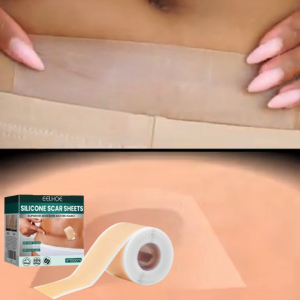EELHOE Silicone Scar Sheets Reusable Type Reducing Treatments Surgical Scars Burn Acne C-Section Cut Into Any Size 4*150cm/box